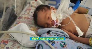 AYUDEMOS al Bebé Mateo de cuatro meses que necesita una operación a corazón abierto