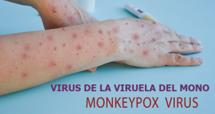 Virus de la Viruela del Mono